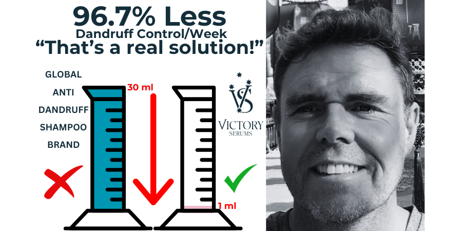 The Case for Not Using Anti-Dandruff Shampoos for Severe or Persistent Dandruff