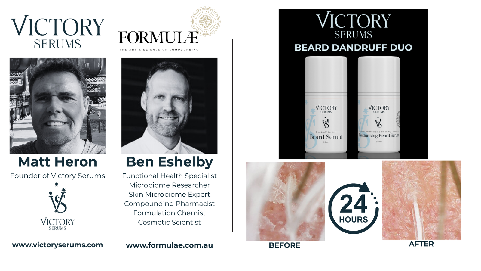 Beard Dandruff Duo - The Next Frontier of Beard Health