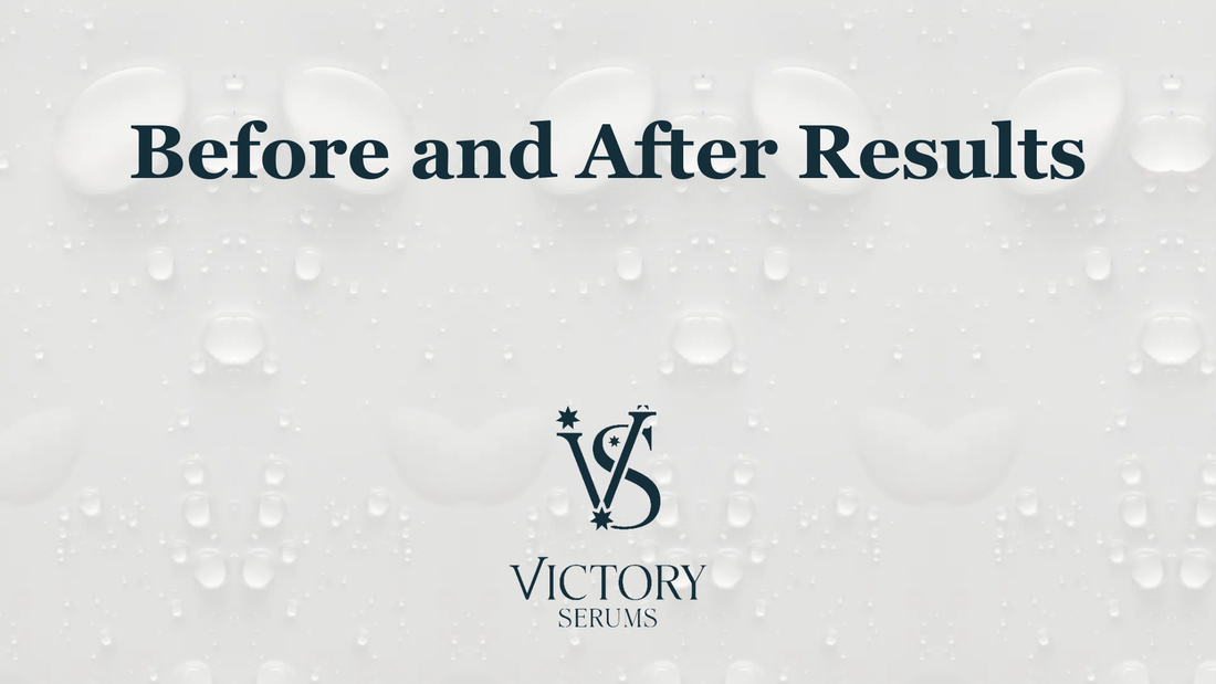 Before and after results: guide to effective scalp care