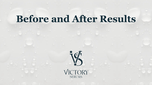Before and after results: guide to effective scalp care