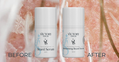 Beard Dandruff Duo - The Ultimate Solution
