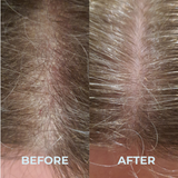 Dandruff Control Suite