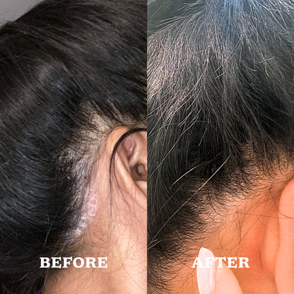 Dandruff Control Intensive Scalp Serum