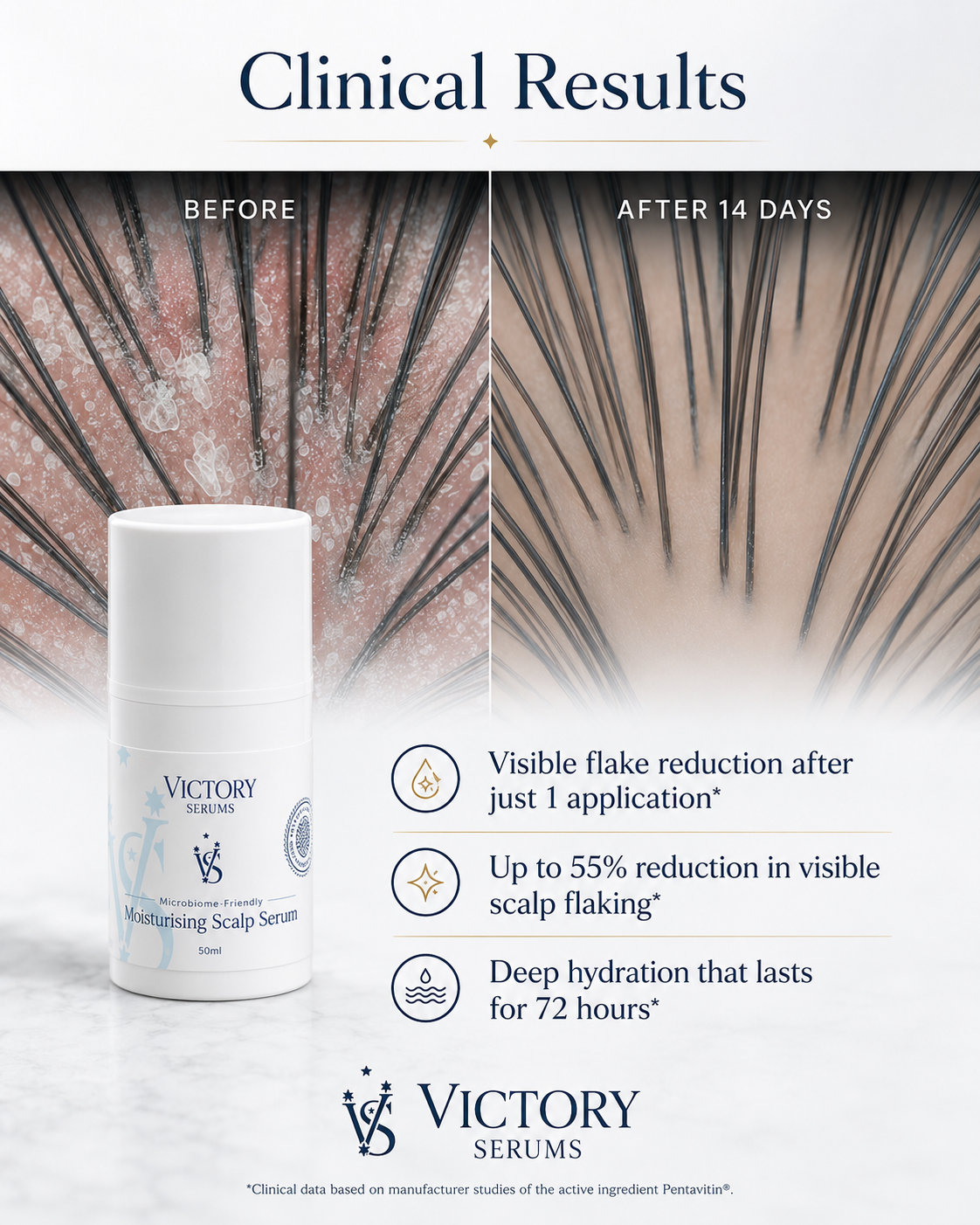Dandruff Relief. Made Simple.