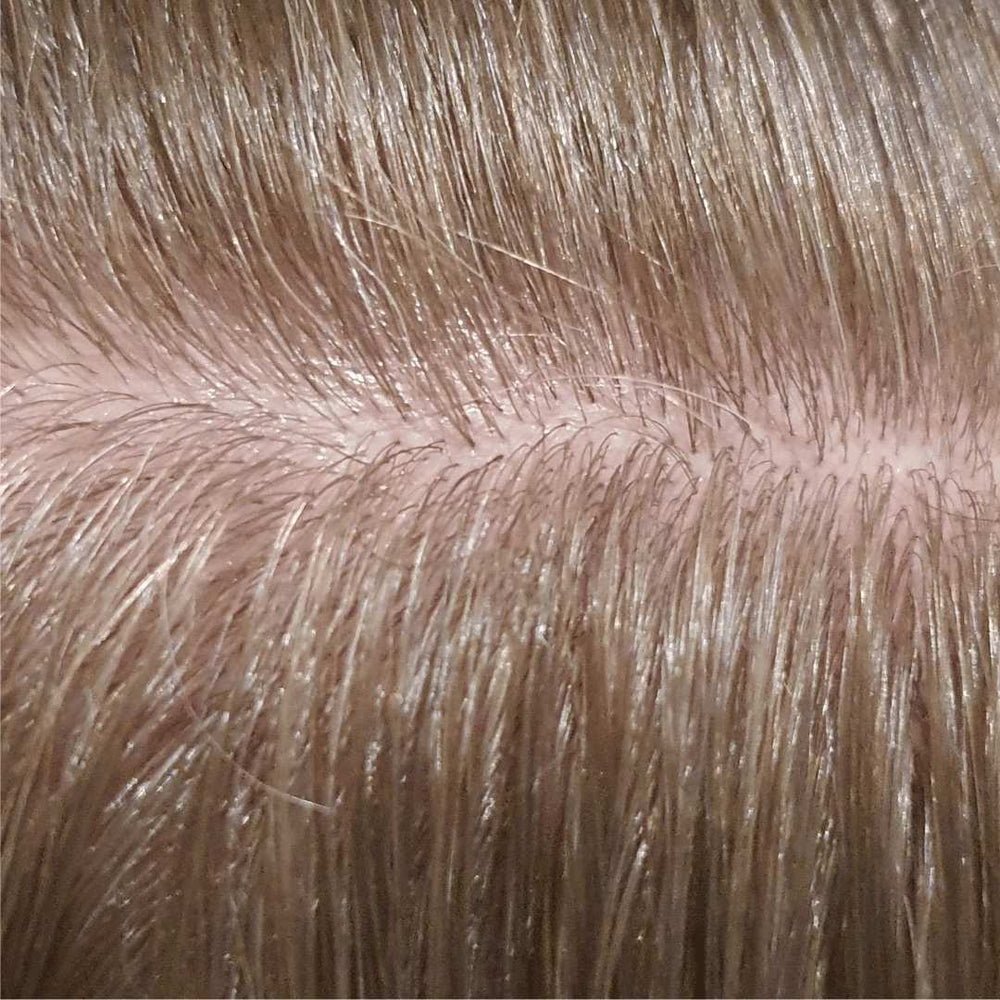 Before and after comparison of hair care treatment on a person's scalp.