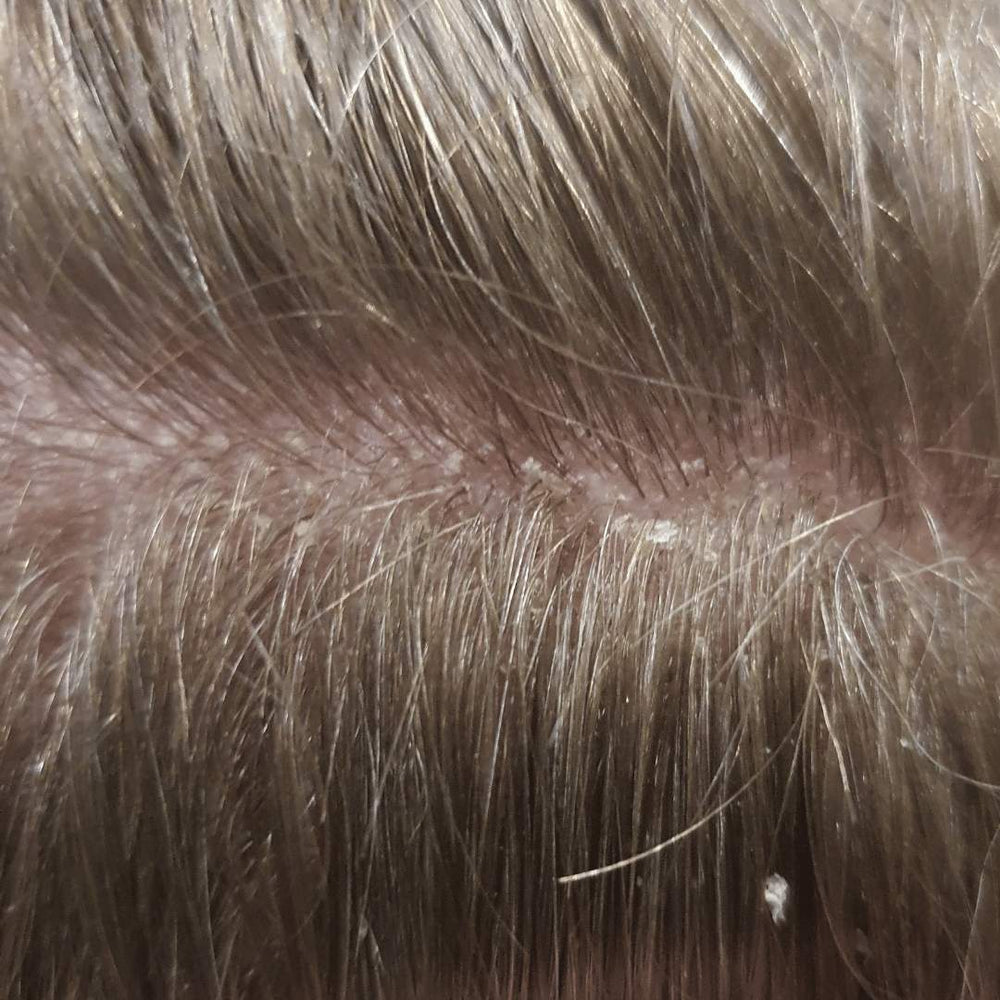 scalp after 55 days no shampoo